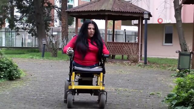 Birth defect lady